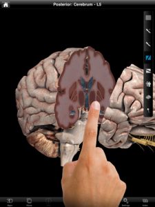Brain Pro