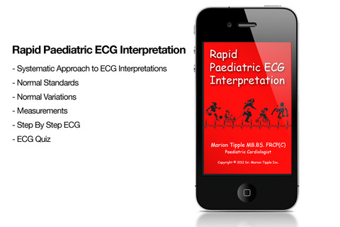 Free EKG Strips
