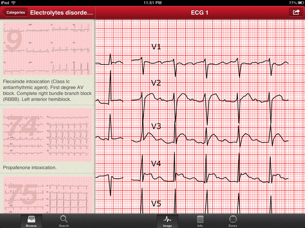 the ecg collection ipad app