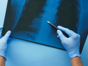 What Is Digital Radiography and How Does It Work?