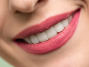 4 Benefits of Opting for Full Mouth Oral Rehabilitation