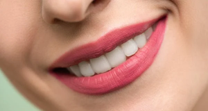 4 Benefits of Opting for Full Mouth Oral Rehabilitation