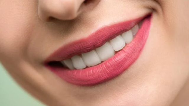 4 Benefits of Opting for Full Mouth Oral Rehabilitation