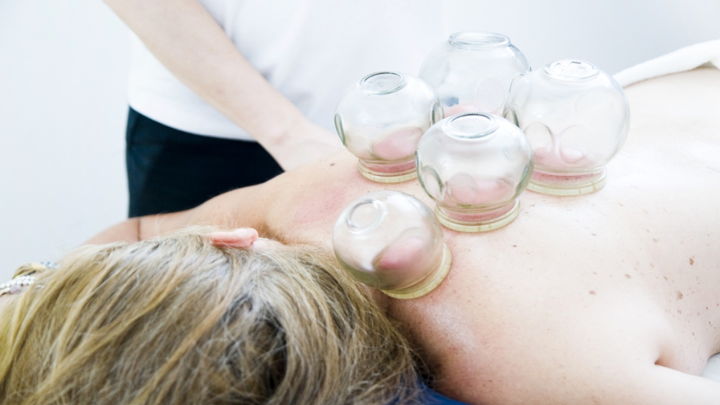 6 Reasons to Consider Chinese Cupping to Improve Your Overall Health