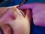 Complete Dental Care Guide: Maintaining Strong Teeth and Gums Image 1 of Complete Dental Care Guide: Maintaining Strong Teeth and Gums