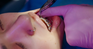 Image 1 of Complete Dental Care Guide: Maintaining Strong Teeth and Gums