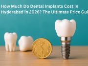 How Much Do Dental Implants Cost in Hyderabad in 2026? The Ultimate Price Guide Dental implant procedure and cost breakdown in Hyderabad – comprehensive price guide
