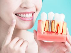 Image 1 of How Diet and Lifestyle Choices Affect Your Oral Health