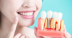 Image 1 of How Diet and Lifestyle Choices Affect Your Oral Health