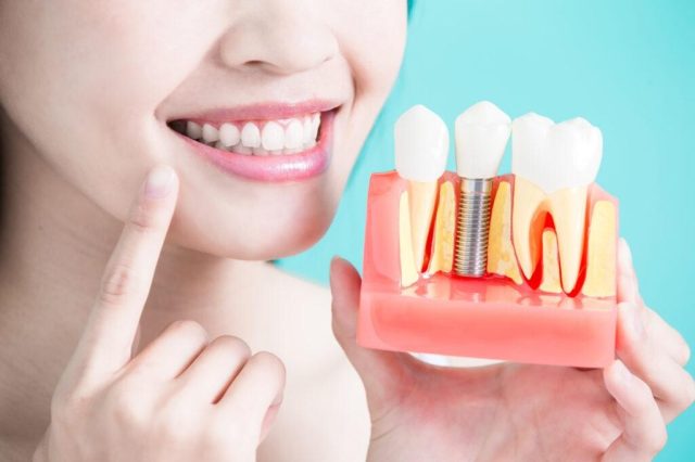 Image 1 of How Diet and Lifestyle Choices Affect Your Oral Health